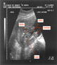 It's a boy! (dames even wegkijken svp)