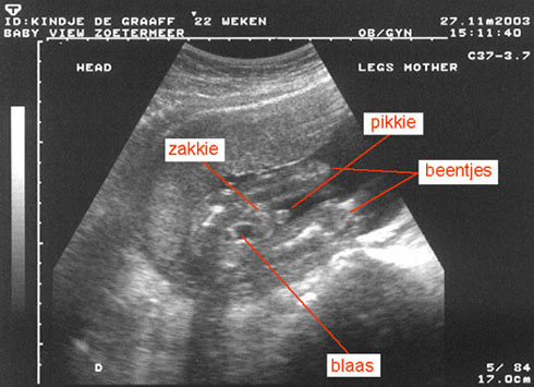It's a boy! (dames even wegkijken svp)